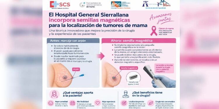 Semillas magnéticas para cirugía de mama en Sierrallana